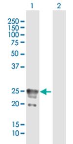 CACNG1 Polyclonal Antibody, MaxPab™