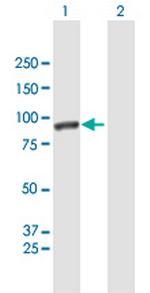 CALD1 Antibody in Western Blot (WB)
