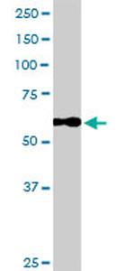 CALD1 Antibody in Western Blot (WB)