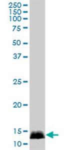 CALML3 Antibody in Western Blot (WB)