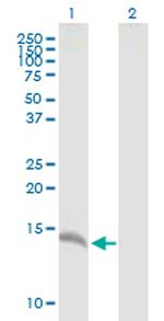 CALML3 Antibody in Western Blot (WB)
