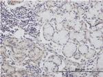 CALML3 Antibody in Immunohistochemistry (Paraffin) (IHC (P))