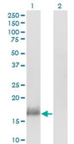 CALML3 Antibody in Western Blot (WB)