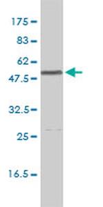 CALR Antibody in Western Blot (WB)