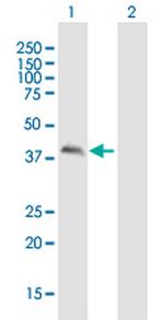 CALU Polyclonal Antibody, MaxPab™