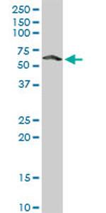 CAMK4 Antibody in Western Blot (WB)
