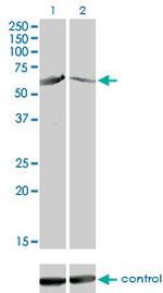 CAMK4 Antibody in Western Blot (WB)
