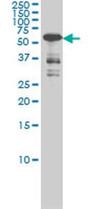 CAMK4 Antibody in Western Blot (WB)