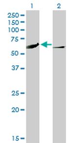 CAMK4 Antibody in Western Blot (WB)