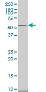 CAMK2A Antibody in Western Blot (WB)