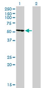 CAMK2B Antibody in Western Blot (WB)