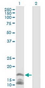 CAMP Antibody in Western Blot (WB)