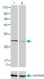 CAPNS1 Antibody in Western Blot (WB)