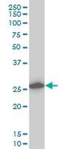 CAPNS1 Antibody in Western Blot (WB)