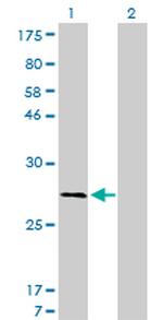 CAPNS1 Antibody in Western Blot (WB)