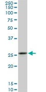 CAPNS1 Antibody in Western Blot (WB)