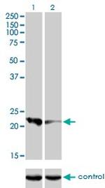 CAPS Monoclonal Antibody (4C6)