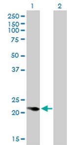 CAPS Antibody in Western Blot (WB)