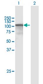 CAST Polyclonal Antibody, MaxPab™