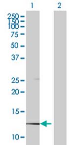 CAPZB Antibody in Western Blot (WB)