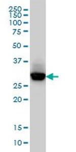 CAPZB Monoclonal Antibody (4H8)