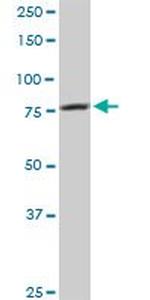 CARS Antibody in Western Blot (WB)