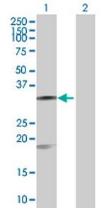 CASP7 Antibody in Western Blot (WB)