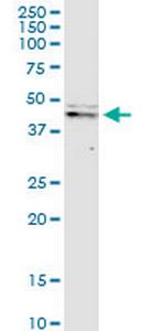 CASP9 Monoclonal Antibody (3B8-4G2)