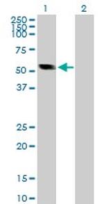 CASQ2 Polyclonal Antibody, MaxPab™