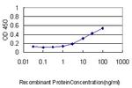 CASQ2 Antibody in ELISA (ELISA)