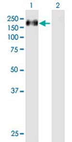 CASR Polyclonal Antibody, MaxPab™