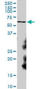 CAT Antibody in Western Blot (WB)
