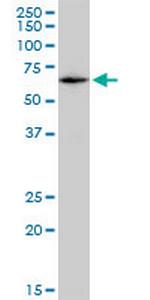 CAT Antibody in Western Blot (WB)