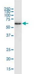 RUNX2 Monoclonal Antibody (2B9)