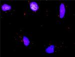 RUNX1T1 Antibody in Proximity Ligation Assay (PLA) (PLA)