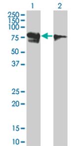 RUNX1T1 Antibody in Western Blot (WB)