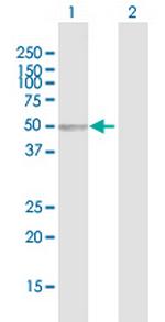 SERPINA6 Antibody in Western Blot (WB)