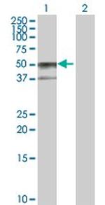SERPINA6 Polyclonal Antibody, MaxPab™