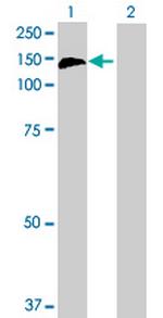 CBL Antibody in Western Blot (WB)