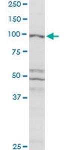 CBL Antibody in Western Blot (WB)