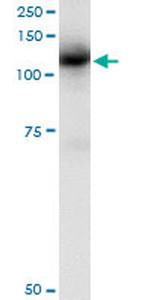 CBL Antibody in Immunoprecipitation (IP)