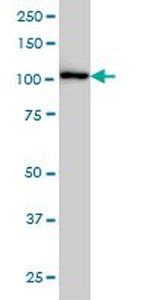 CBL Antibody in Western Blot (WB)