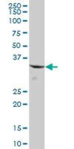 CBR1 Antibody in Western Blot (WB)