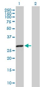 CBR1 Polyclonal Antibody, MaxPab™