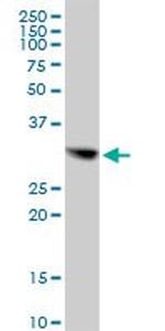CBR1 Antibody in Western Blot (WB)