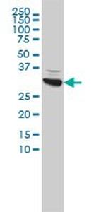 CBR1 Monoclonal Antibody (4D12-1G8)