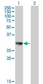 CBR3 Polyclonal Antibody, MaxPab™