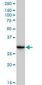 CBR3 Monoclonal Antibody (1G8)