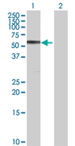 CBS Polyclonal Antibody, MaxPab™