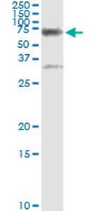 CBS Antibody in Immunoprecipitation (IP)